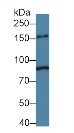 Polyclonal Antibody to Phospholipase C Beta 3, Phosphoinositide Specific (PLCb3)