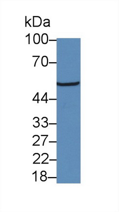 Polyclonal Antibody to Glucocorticoid Receptor (GR)