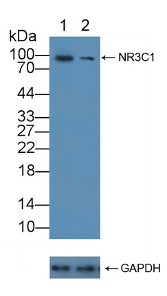 Polyclonal Antibody to Glucocorticoid Receptor (GR)