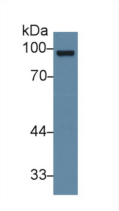 Polyclonal Antibody to Glucocorticoid Receptor (GR)