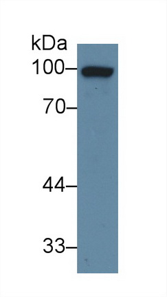 Polyclonal Antibody to Glucocorticoid Receptor (GR)