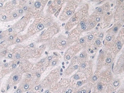 Polyclonal Antibody to Glucocorticoid Receptor (GR)