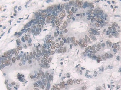 Polyclonal Antibody to Glucocorticoid Receptor (GR)