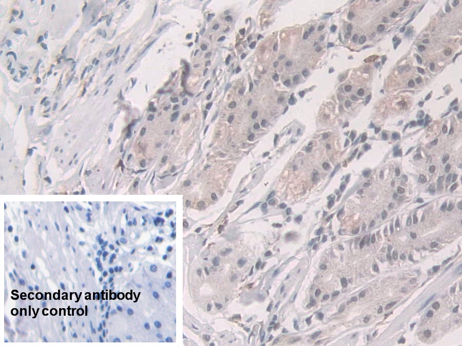 Polyclonal Antibody to Glucocorticoid Receptor (GR)