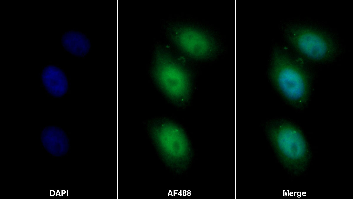 Polyclonal Antibody to Glucocorticoid Receptor (GR)