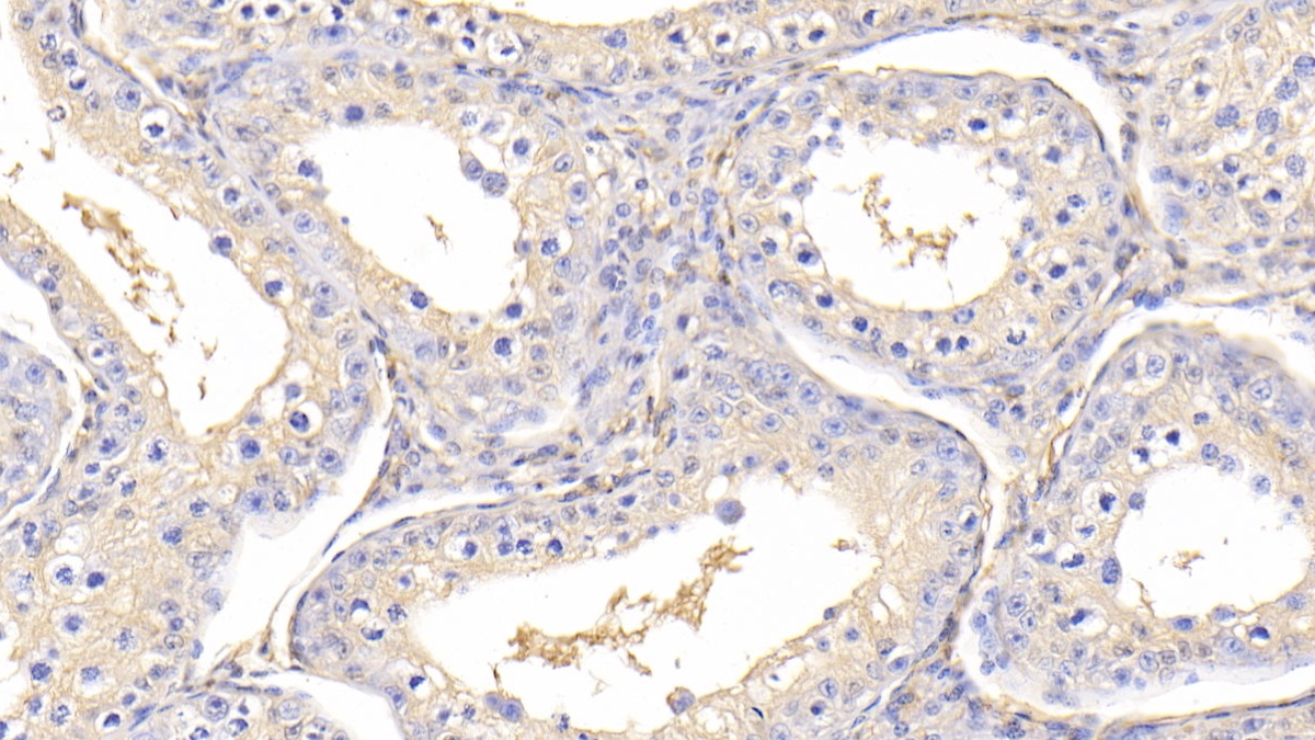 Polyclonal Antibody to Thymosin Beta 4 (TMSB4X)