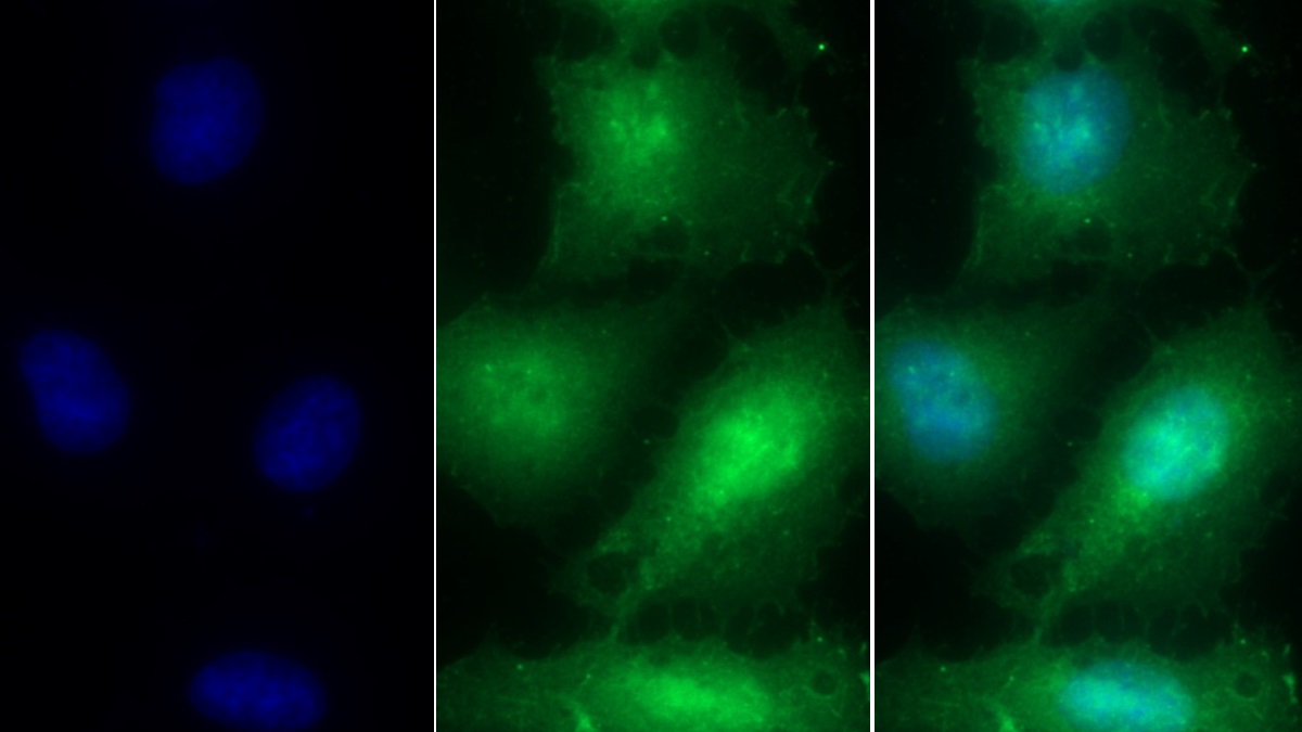 Polyclonal Antibody to Thymosin Beta 4 (TMSB4X)