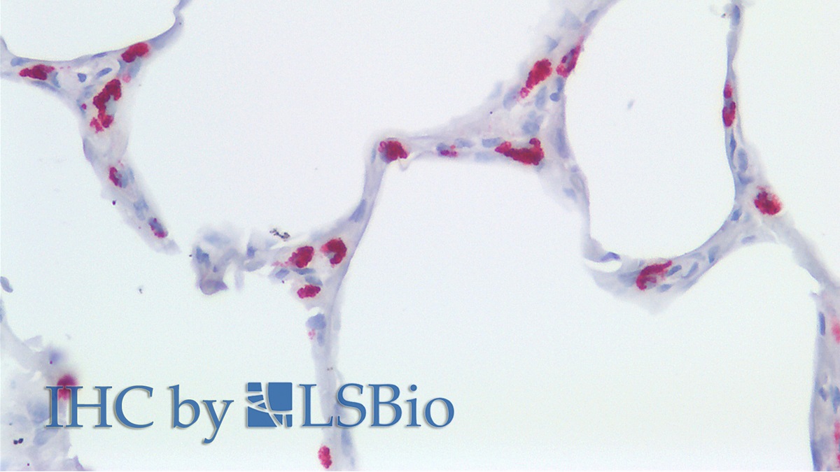 Polyclonal Antibody to Lysosomal Associated Membrane Protein 3 (LAMP3)