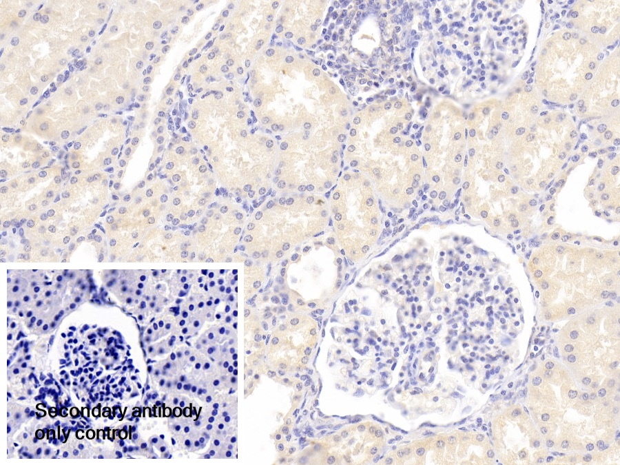 Polyclonal Antibody to Lysosomal Associated Membrane Protein 3 (LAMP3)