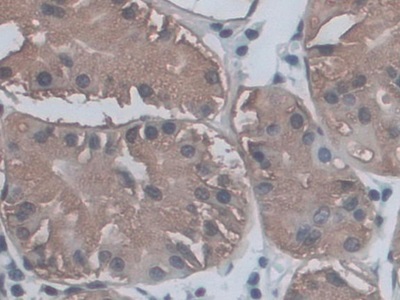 Polyclonal Antibody to Cluster Of Differentiation 209 (CD209)