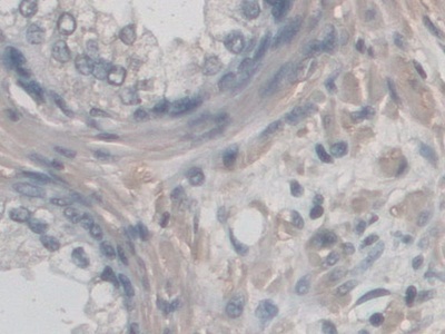 Polyclonal Antibody to Cluster Of Differentiation 209 (CD209)