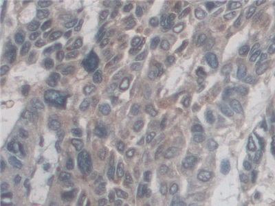 Polyclonal Antibody to Cluster Of Differentiation 209 (CD209)