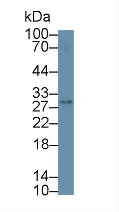 Polyclonal Antibody to Cluster Of Differentiation 209 (CD209)