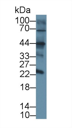 Polyclonal Antibody to Cluster Of Differentiation 209 (CD209)