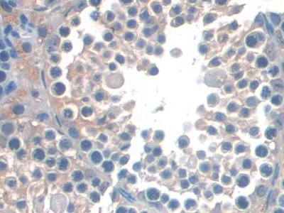 Polyclonal Antibody to Cluster Of Differentiation 209 (CD209)