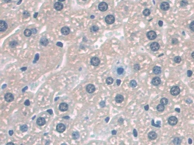 Polyclonal Antibody to Cluster Of Differentiation 209 (CD209)