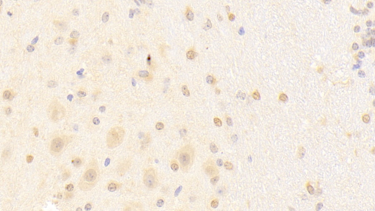 Polyclonal Antibody to Protocadherin Alpha 1 (PCDHa1)