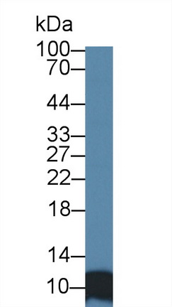 Polyclonal Antibody to Signal Recognition Particle 9kDa (SRP9)