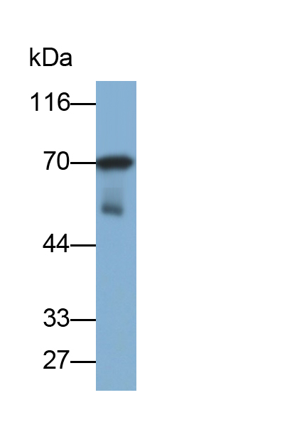 Polyclonal Antibody to C4 Binding Protein Alpha (C4BPa)