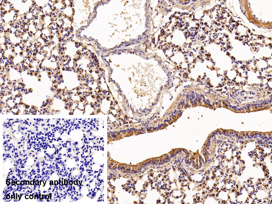 Polyclonal Antibody to Surfactant Protein B (SP-B)