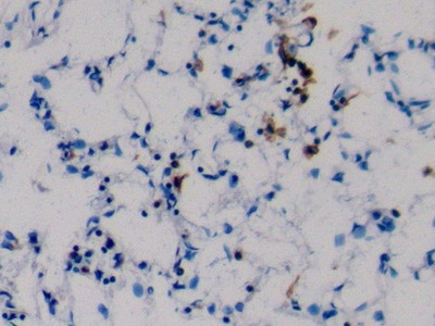 Polyclonal Antibody to Surfactant Protein C (SP-C)