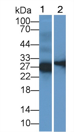 Polyclonal Antibody to Surfactant Protein C (SP-C)