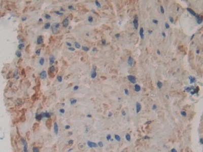 Polyclonal Antibody to Cytosolic Phospholipase A2 (PLA2G4)