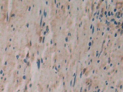 Polyclonal Antibody to Cytosolic Phospholipase A2 (PLA2G4)