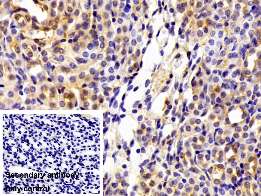 Polyclonal Antibody to Cytosolic Phospholipase A2 (PLA2G4)