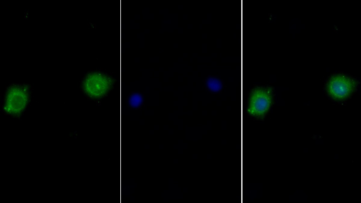 Polyclonal Antibody to Interleukin 10 Receptor Alpha (IL10Ra)