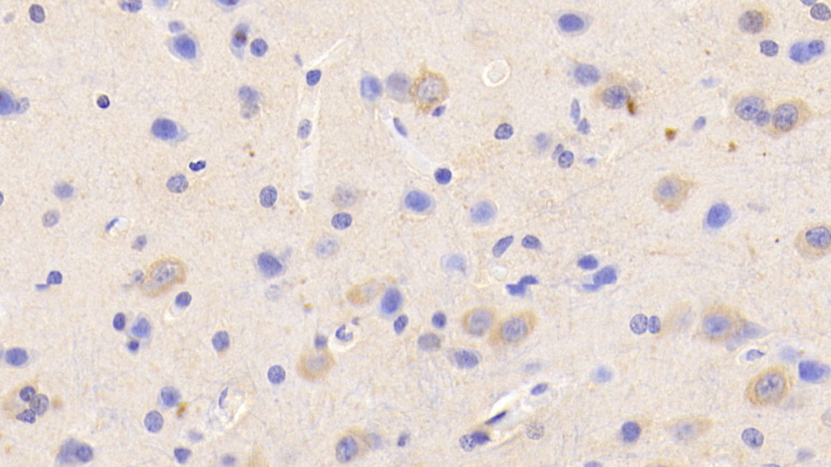 Polyclonal Antibody to Potassium Chloride Cotransporters 4 (KCC4)