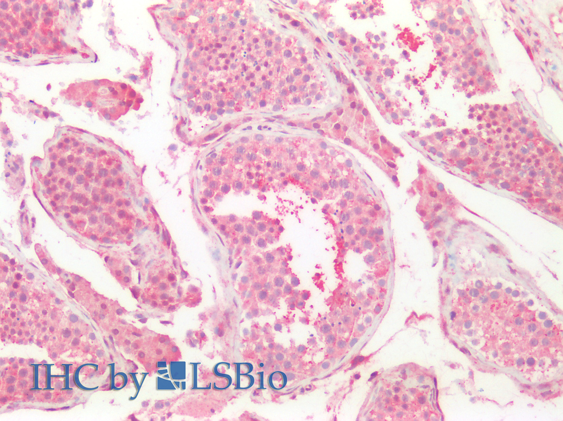 Polyclonal Antibody to Potassium Chloride Cotransporters 4 (KCC4)