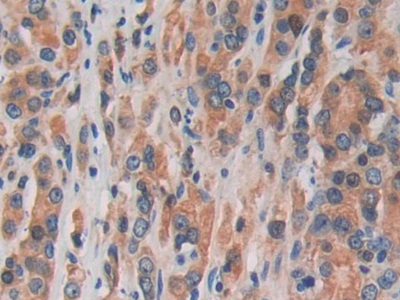 Polyclonal Antibody to MAP Kinase Activated Protein Kinase 3 (MAPKAPK3)