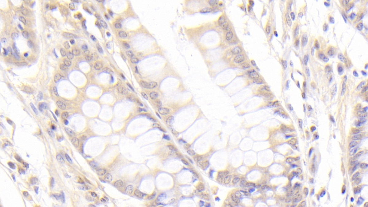 Polyclonal Antibody to Peptidylprolyl Isomerase C (PPIC)