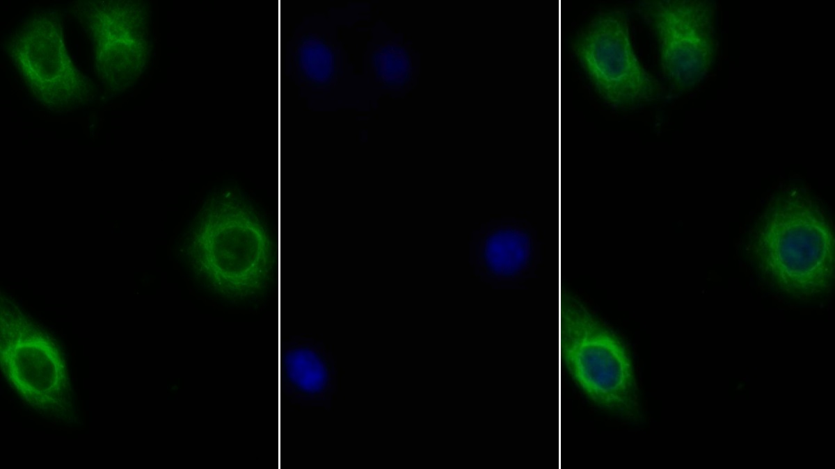 Polyclonal Antibody to Interleukin 10 Receptor Beta (IL10Rb)