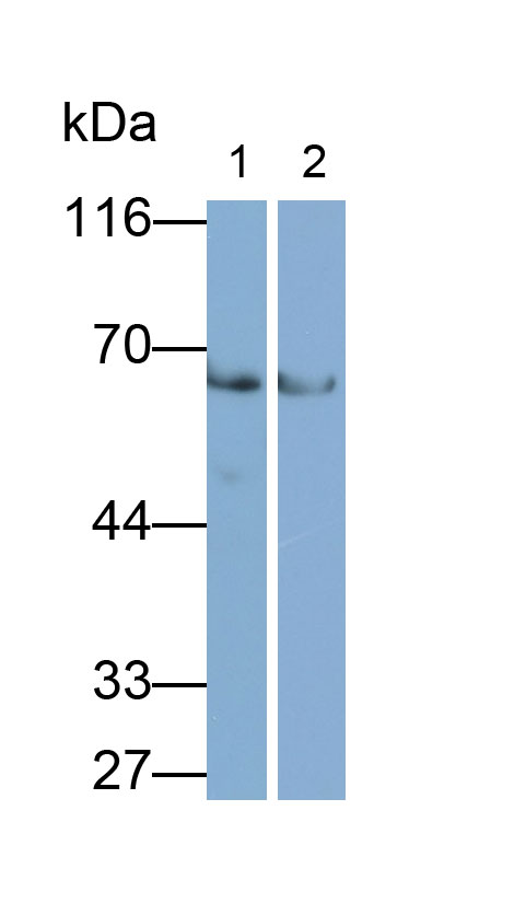 Polyclonal Antibody to Interleukin 12 Receptor Beta 1 (IL12Rb1)