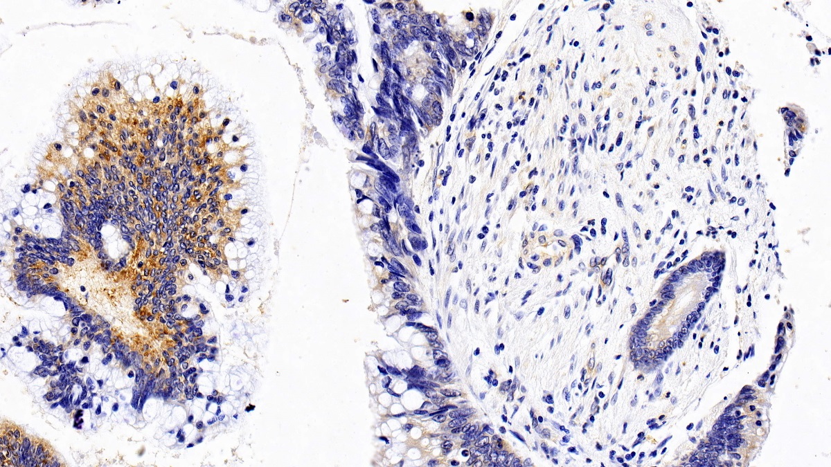 Polyclonal Antibody to Interleukin 12 Receptor Beta 1 (IL12Rb1)