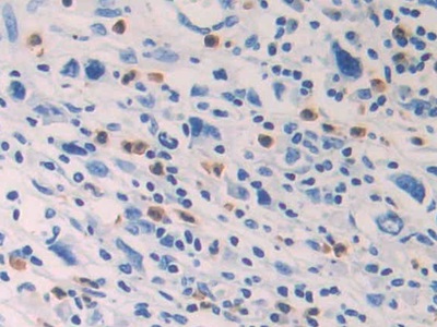 Polyclonal Antibody to Prostaglandin D2 Synthase (PTGDS)