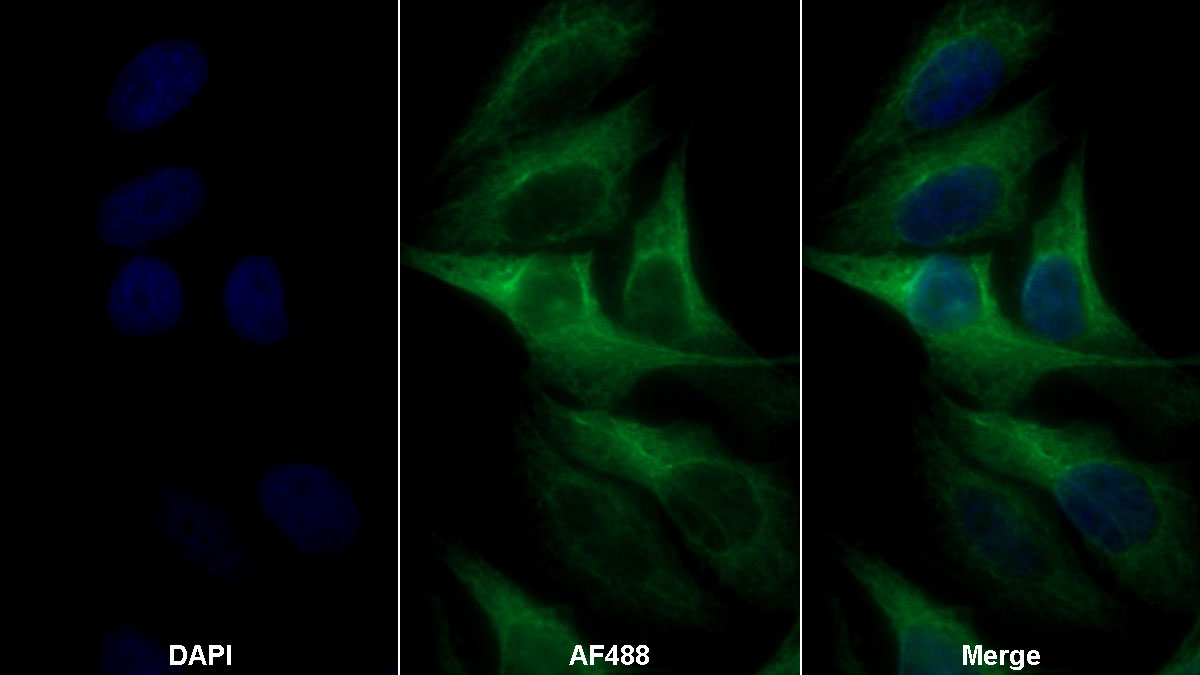 Polyclonal Antibody to Interleukin 13 Receptor Alpha 1 (IL13Ra1)