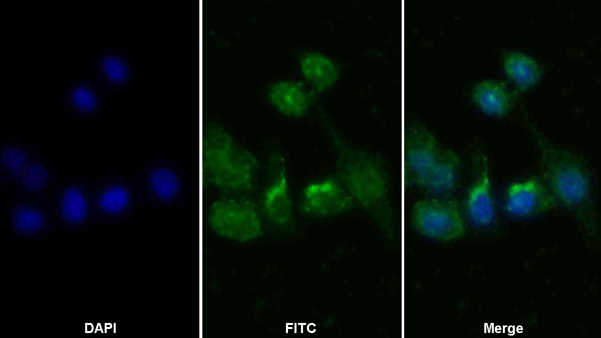 Polyclonal Antibody to Interleukin 13 Receptor Alpha 1 (IL13Ra1)