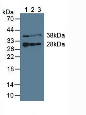 Polyclonal Antibody to Electron Transfer Flavoprotein Beta Polypeptide (ETFb)