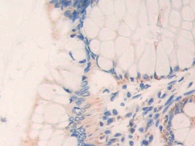 Polyclonal Antibody to Electron Transfer Flavoprotein Beta Polypeptide (ETFb)