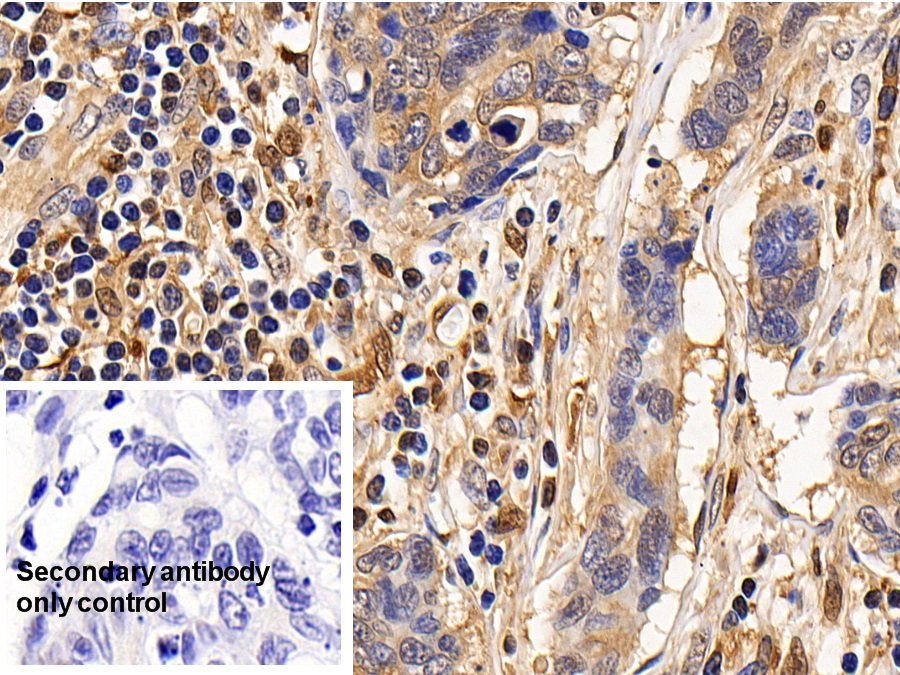 Polyclonal Antibody to Interleukin 13 Receptor Alpha 2 (IL13Ra2)