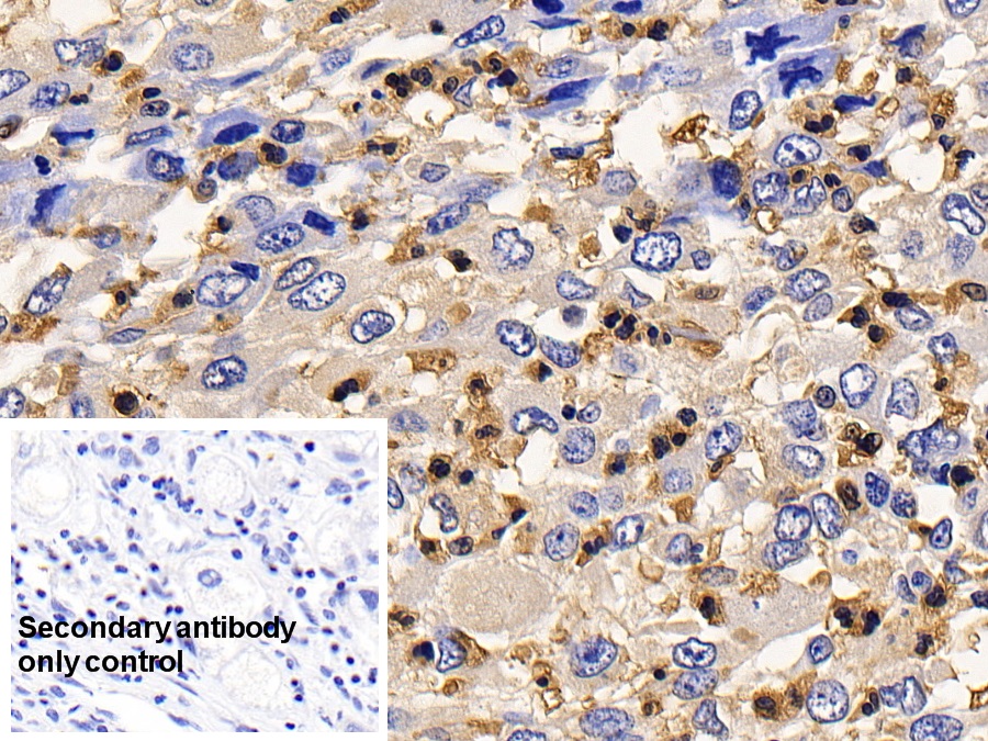 Polyclonal Antibody to Interleukin 13 Receptor Alpha 2 (IL13Ra2)