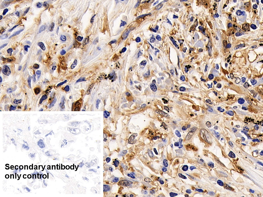 Polyclonal Antibody to Interleukin 13 Receptor Alpha 2 (IL13Ra2)