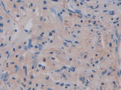 Polyclonal Antibody to Interleukin 17 Receptor A (IL17RA)