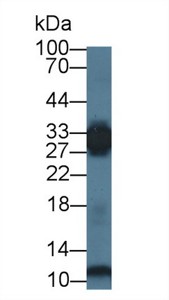 Polyclonal Antibody to Phosphoglycerate Mutase 2, Muscle (PGAM2)