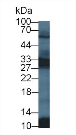 Polyclonal Antibody to Phosphoglycerate Mutase 2, Muscle (PGAM2)