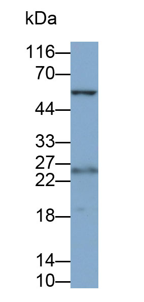 Polyclonal Antibody to Major Basic Protein (MBP)