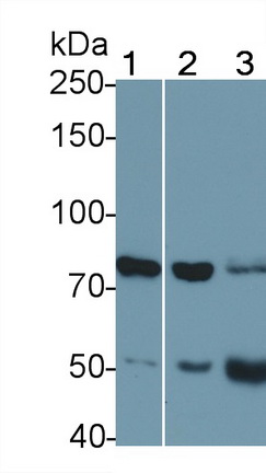 Polyclonal Antibody to Interleukin 18 Receptor 1 (IL18R1)